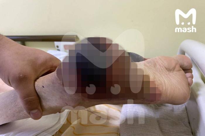 В Обнинске минимум 20 человек обварились кипятком из-за бездействия УК. Фото © Telegram / Mash