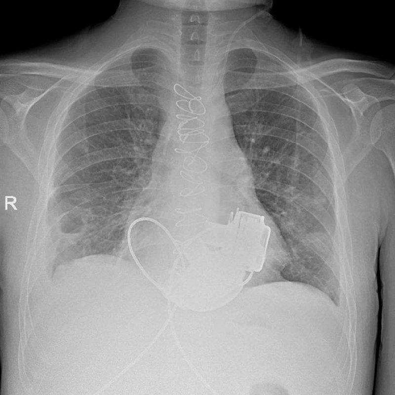    Фото: https://t.me/komzdravspb/7391