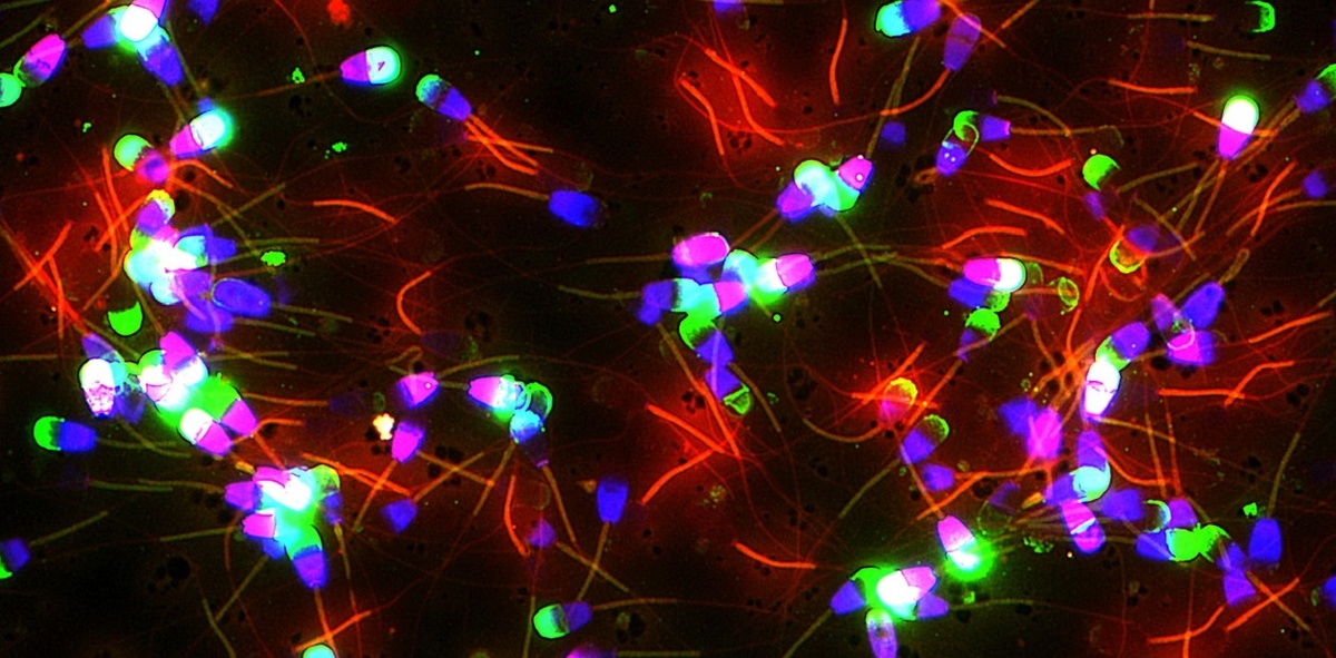 Сперматозоиды из придатка яичка белохвостого оленя. Головки окрашены окрашена зеленым, фиолетовым или розовым, хвосты – красным. Чем ярче окрашивание, тем выше способность сперматозоида к оплодотворению. Флуоресцентная микроскопия. © CC BY 4.0 /Theprevetvikng