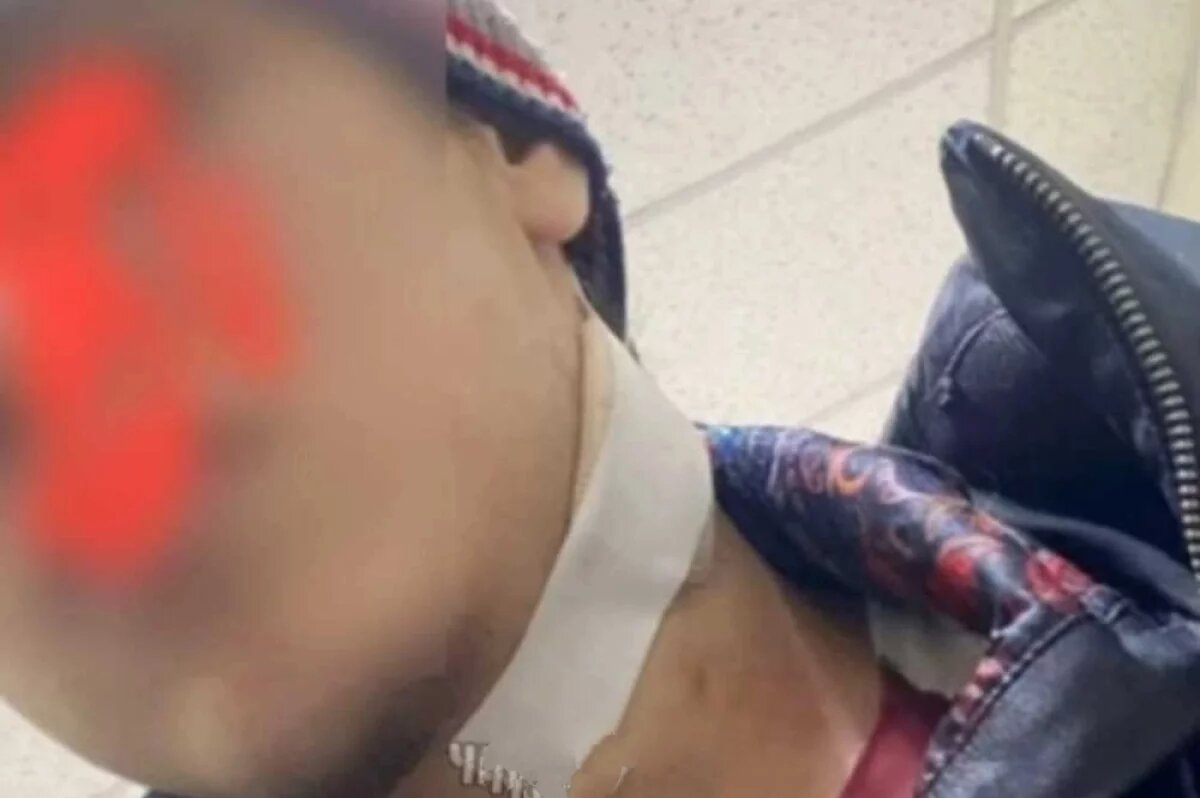    Рану молодому человеку благополучно обработали и забинтовали.