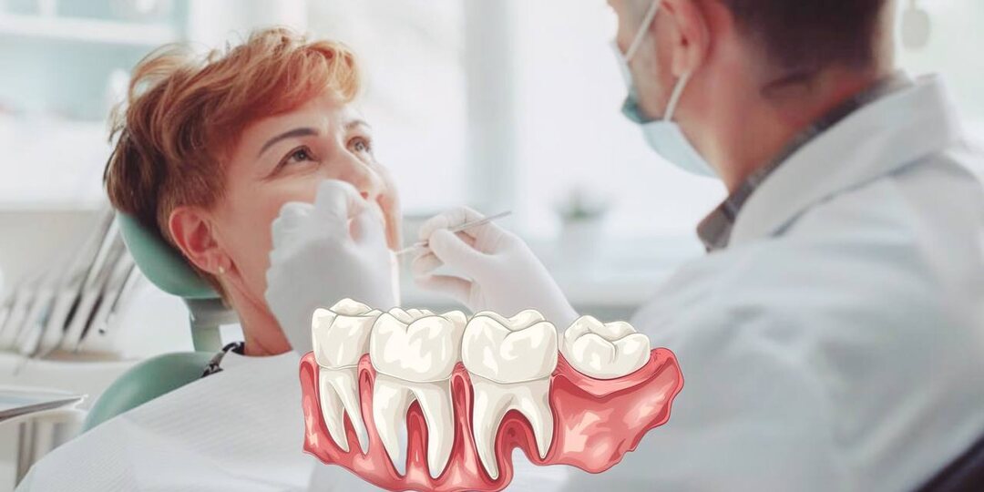 Удаление зуба мудрости без разреза фантастика или реальность? Что недоговаривают стоматологи