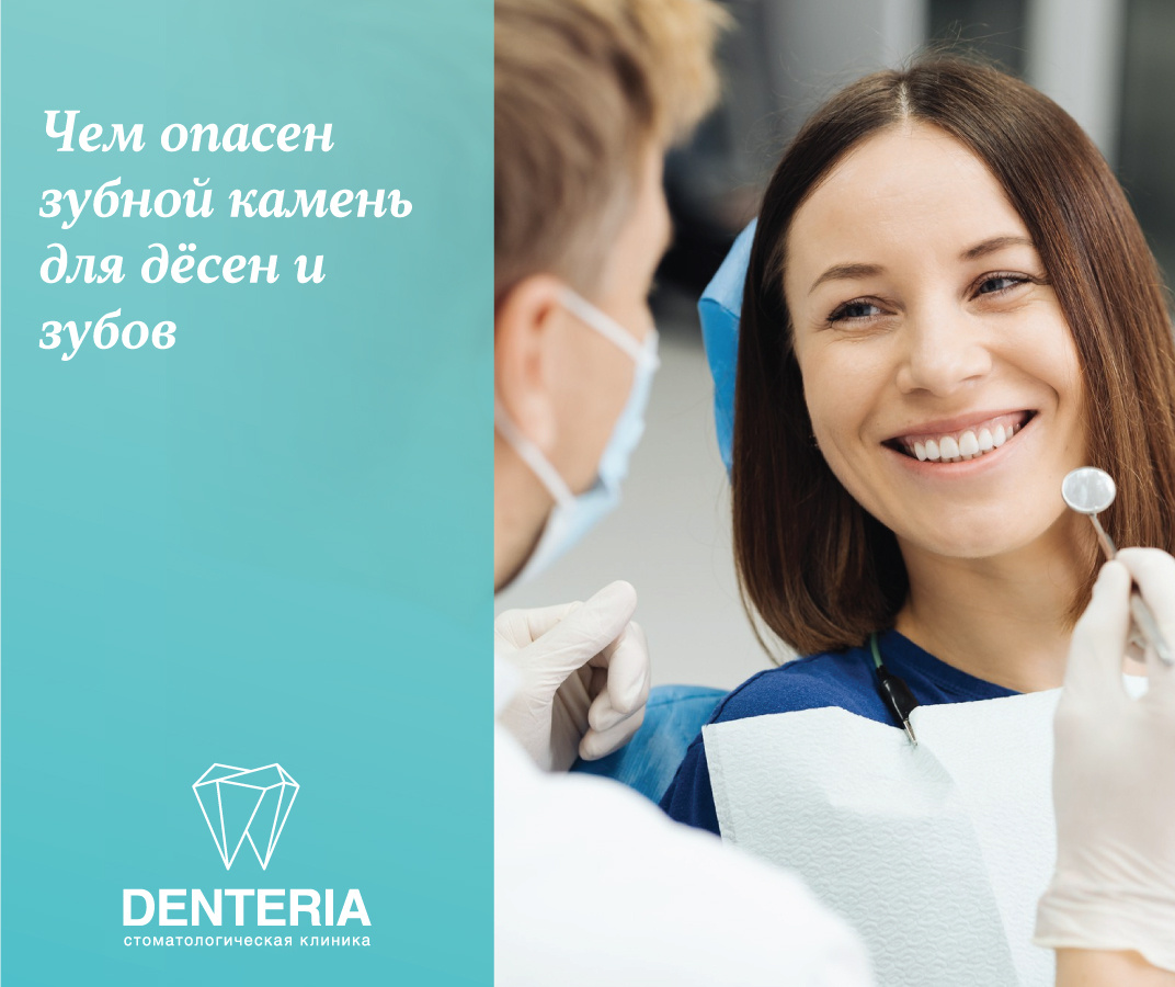 Чем опасен зубной камень для дёсен и зубов
