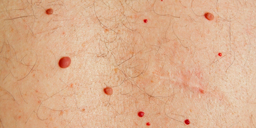 Красные пятна на теле: что они могут означать