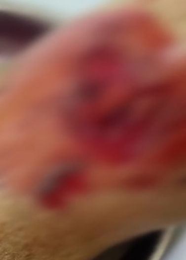 Раны на руках Марии 