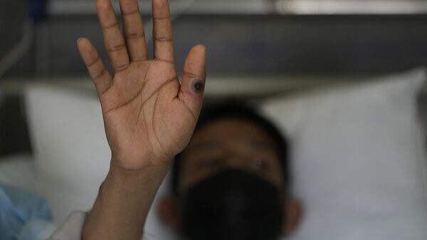    © AP Photo Martin Mejia