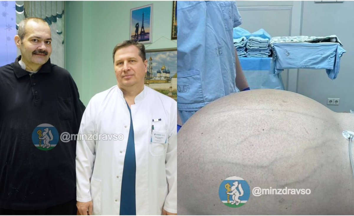 Пациента уже выписали домой. Фото: Минздрав Свердловской области