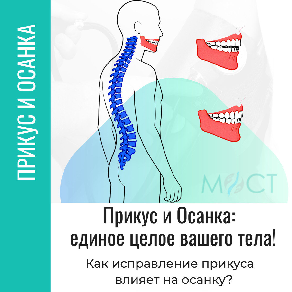 Лечение прикуса и осанки с помощью остеопатии в Санкт-Петербурге