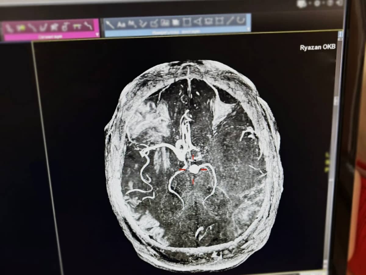    В Рязани спасли мужчину с инсультом. Фото: ОКБ