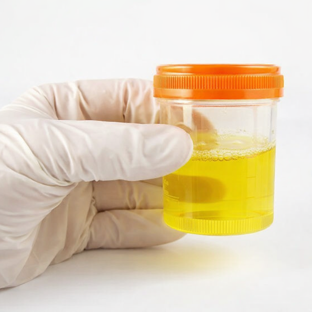 Фото с сайта "Екатеринбургский Медицинский Центр"