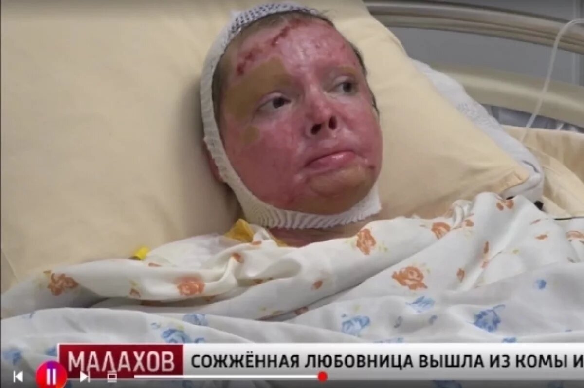    «Видела, как сползает моя кожа».