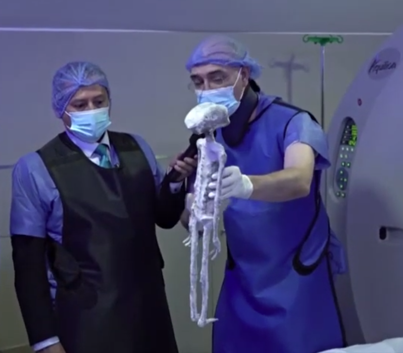 "Инопланетная" мумия в руках мексиканского судмедэксперта