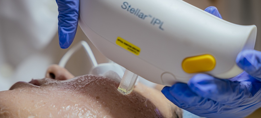 IPL даёт ровный тон и меньше покраснений и пятен, но результат зависит от диагностики, точных настроек и правильно подобранного курса под ваш фототип и задачи кожи.