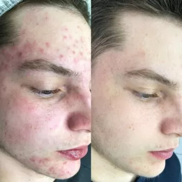 Результат клиента ПОСЛЕ процедуры