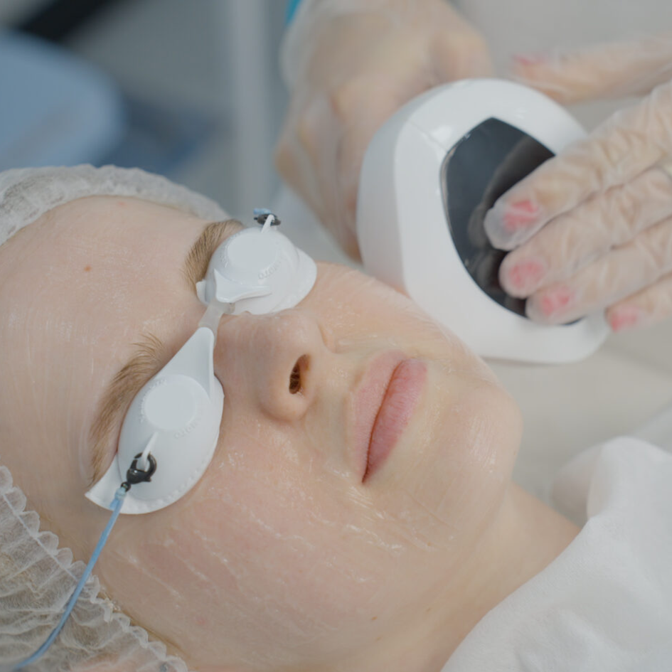 Lumecca — более мощная и точная версия IPL для пятен и красноты, а лазер чаще выбирают для выраженной работы с текстурой и обновлением кожи.