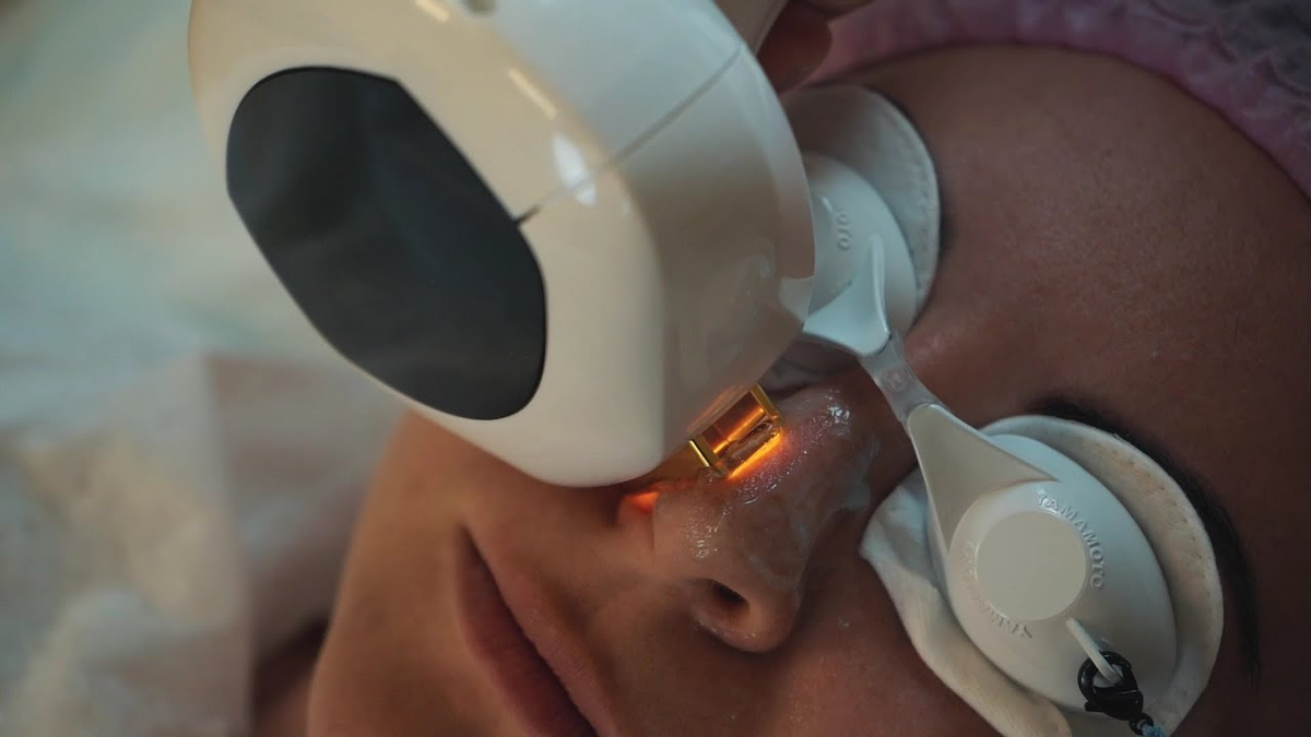 Lumecca обычно переносится комфортно: короткие “щелчки” и тепло, лёгкое покраснение после, без тяжёлой реабилитации — но с обязательной защитой от солнца и бережным уходом в первые дни.