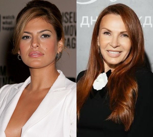 Ева Мендес, Хлои Кардашьян, Эвелина Бледанс: кто из звезд сделал нитевой лифтинг