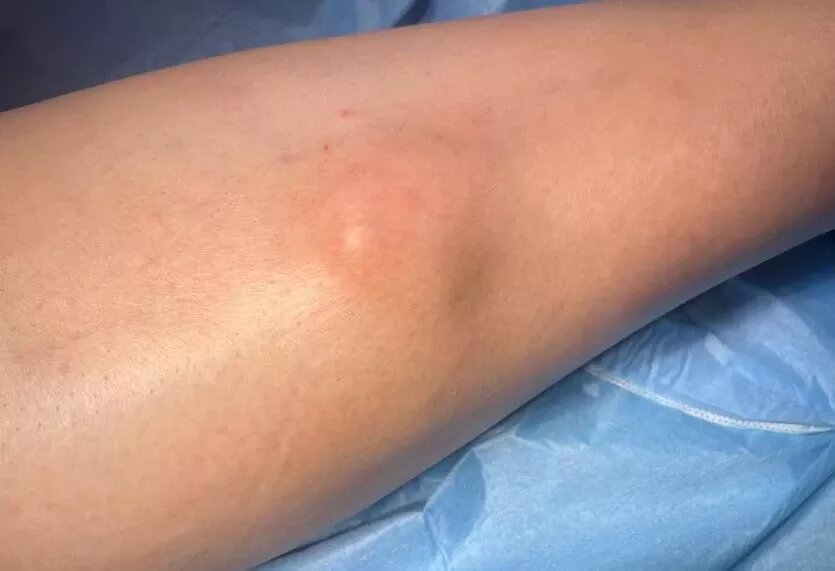 Фото: телеграм-канал Минздравствуйте