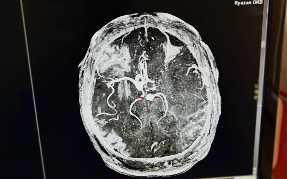 Иллюстрации:  минздрав Рязанской области