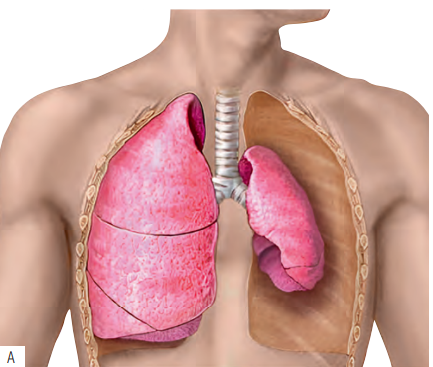Открывая грудную клетку: современные алгоритмы для торакального хирурга