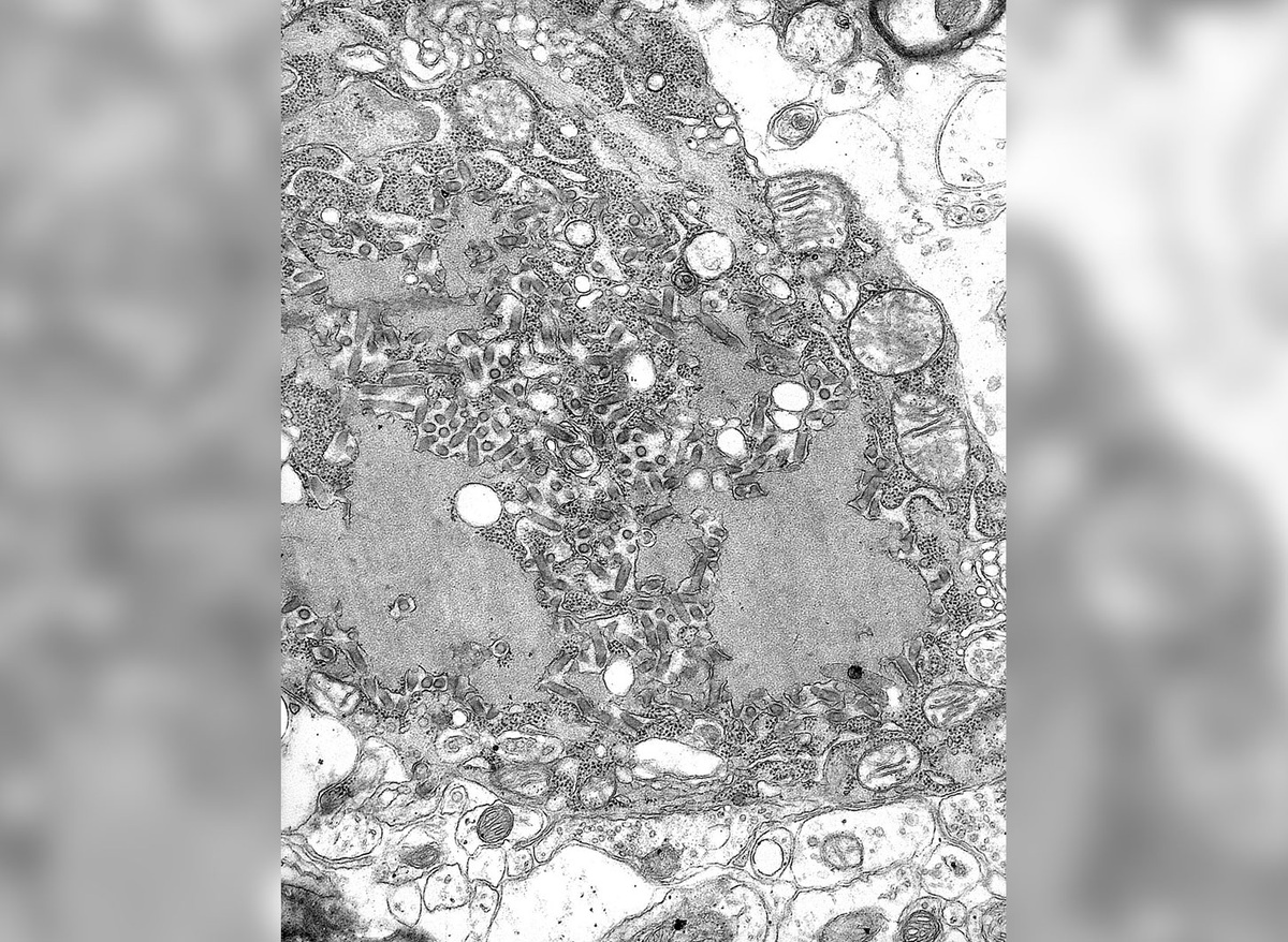    Вирус бешенства под электронным микроскопом. Источник изображения: wikipedia.org