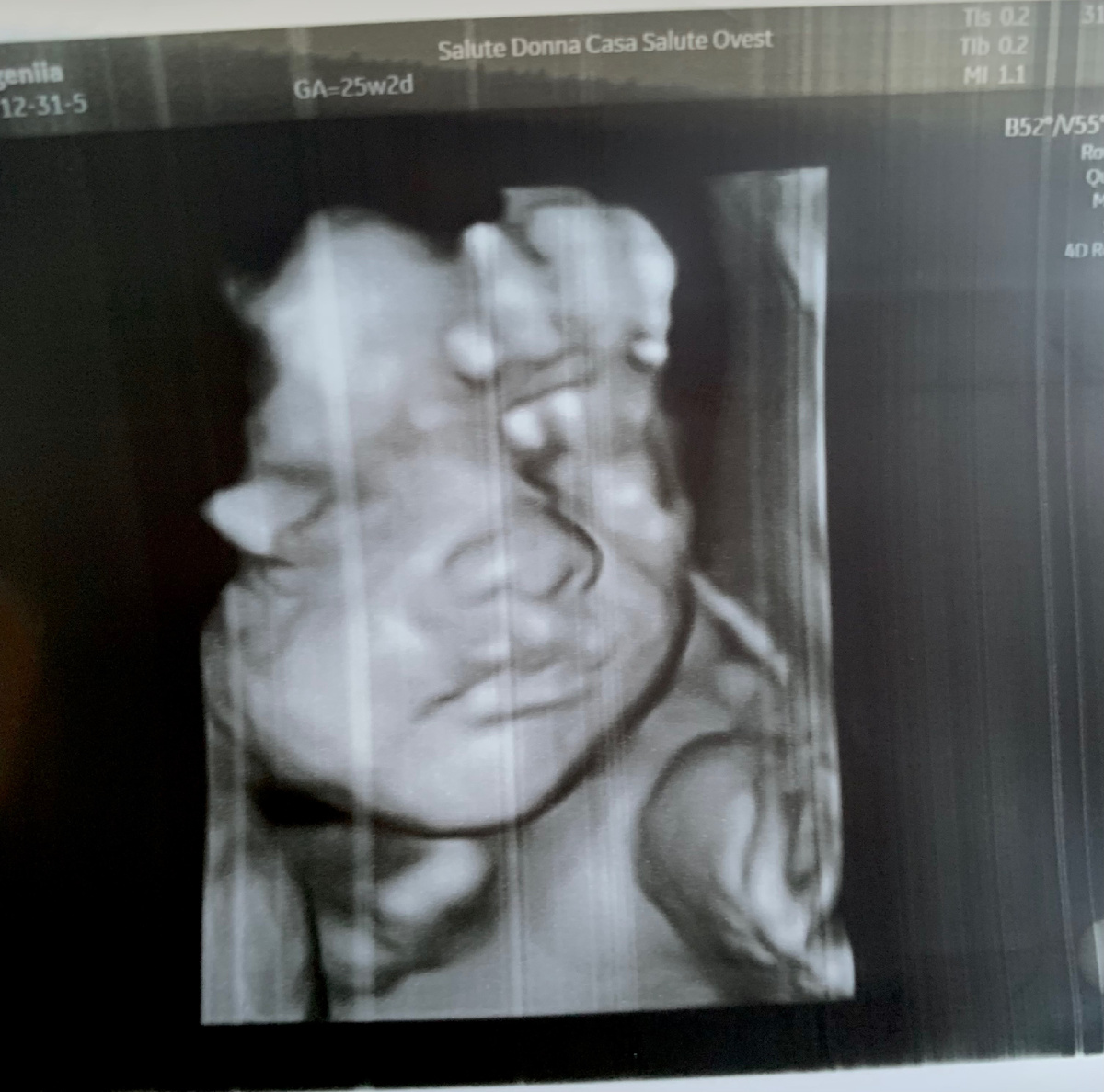 Фото из архива автора. https://t.me/ne_pizzei_edinoi