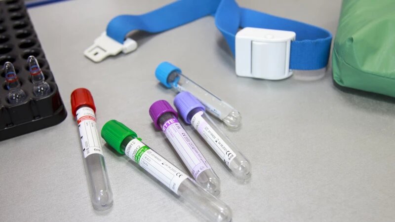     Анализы. Анна Зайкова