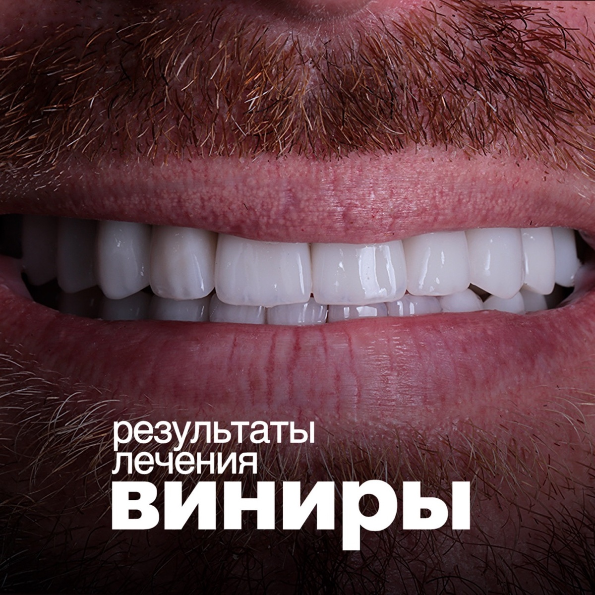 Клинический случай стоматолога-ортопеда, Завена Терзяна.