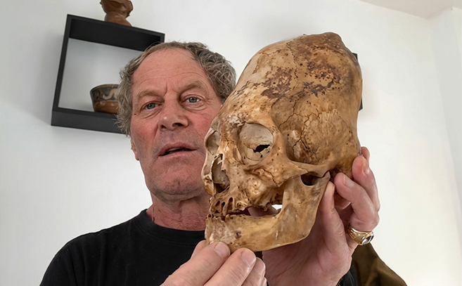 Брайан Ферстер держит вытянутый череп