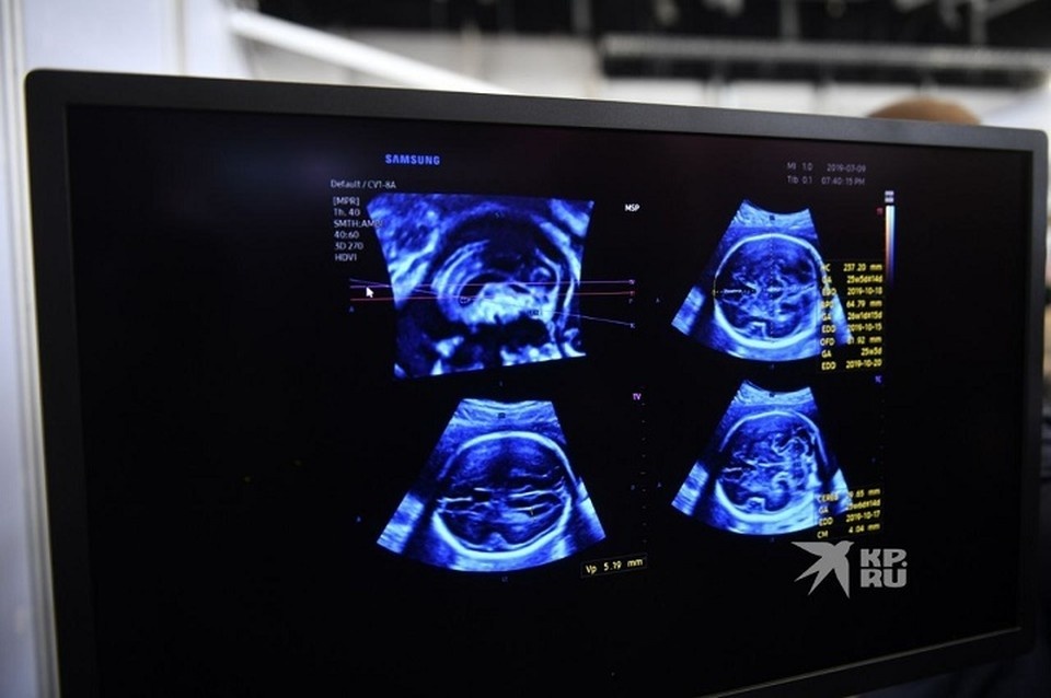    Свердловские онкологи добились снижения смертности от рака Ольга ЮШКОВА