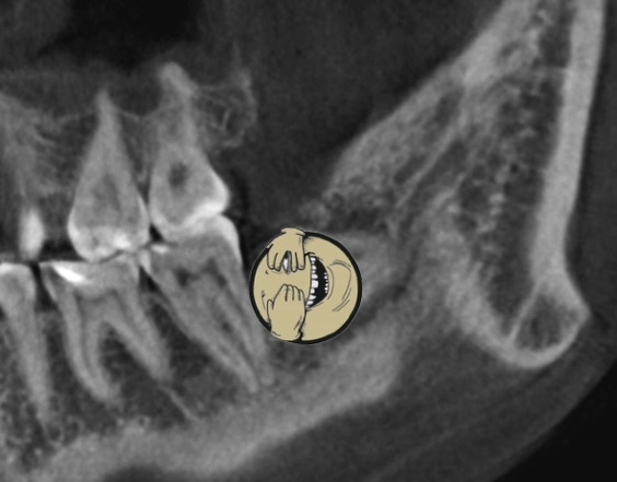 Одна из моих омерзительных восьмерок передает привет