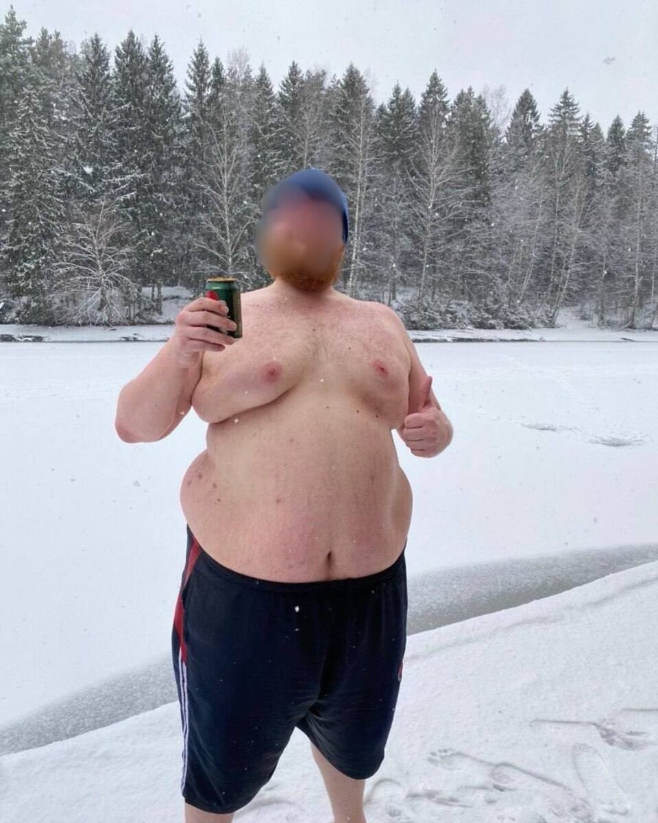 Так пациент выглядел до похудения