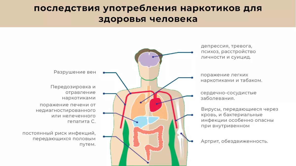 Последствия употребления наркотивков для здоровья человека (фото интернет)