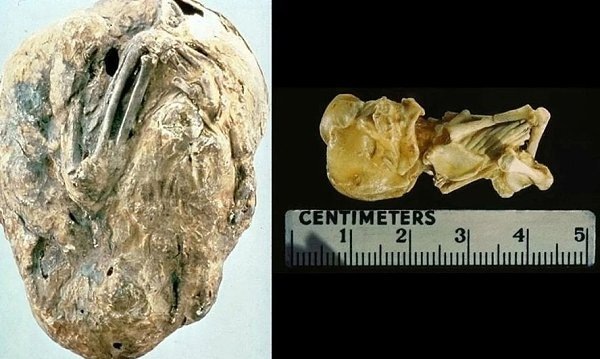 Эмбрион. Фото из открытого источника