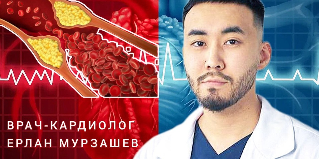 Могут ли быть чистыми сосуды при высоком холестерине