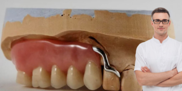 Сэкономил 80 000, но потерял последние оставшиеся зубы: почему кламмерные протезы продолжают втюхивать, не говоря о последствиях