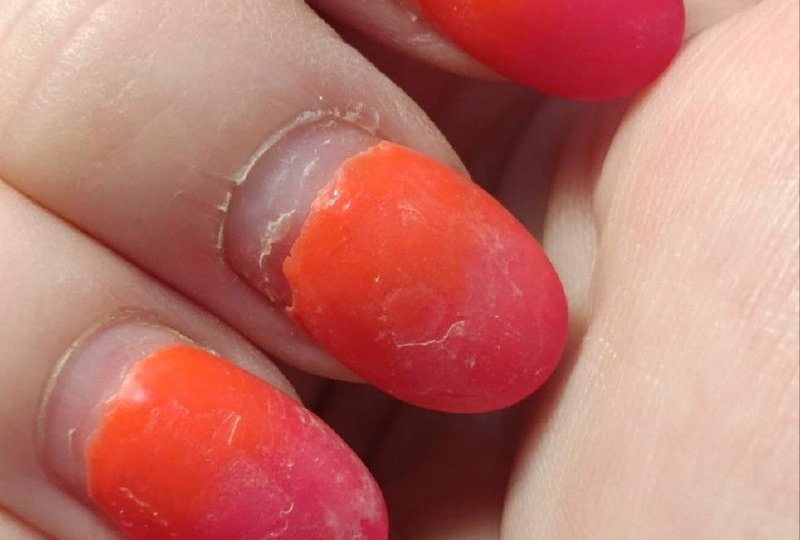 НЕОЧЕВИДНАЯ ПРИЧИНА ОТСЛОЕК, о которой часто забывают