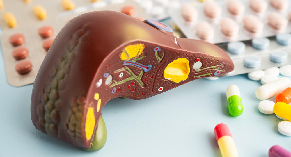 Ранняя стадия цирроза печени: как вовремя заметить изменения