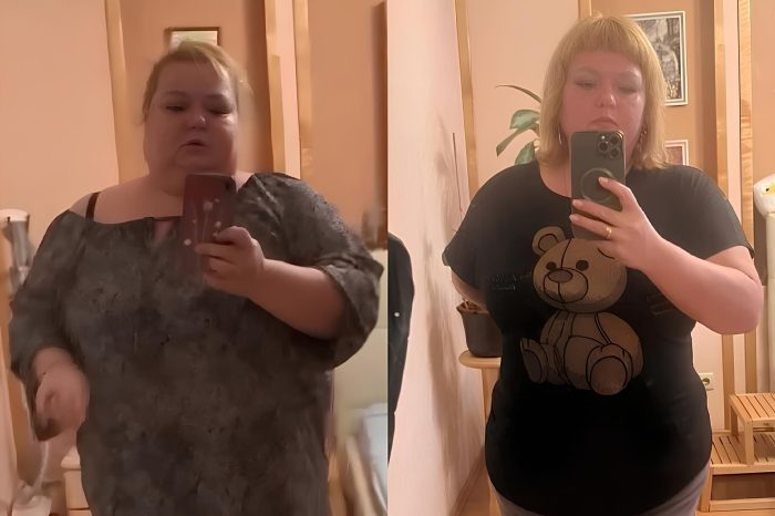 Смущение перед врачами мотивировало жительницу Новосибирска сбросить 50 кг