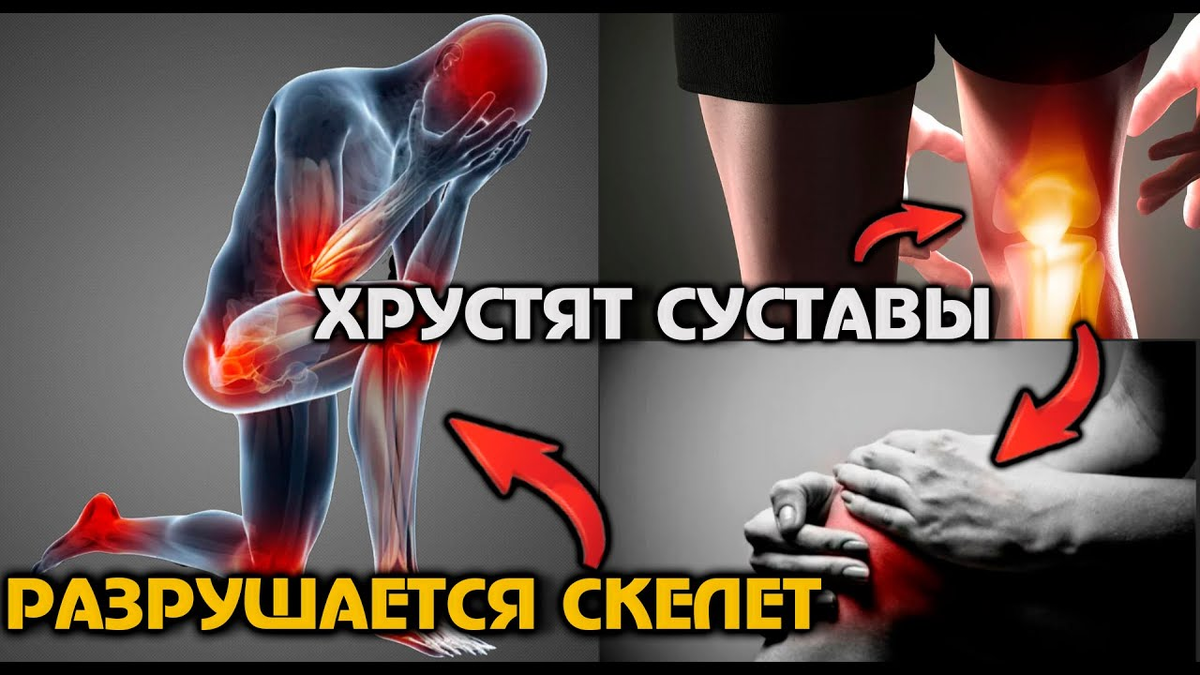 Хрустят суставы — мало кальция!?