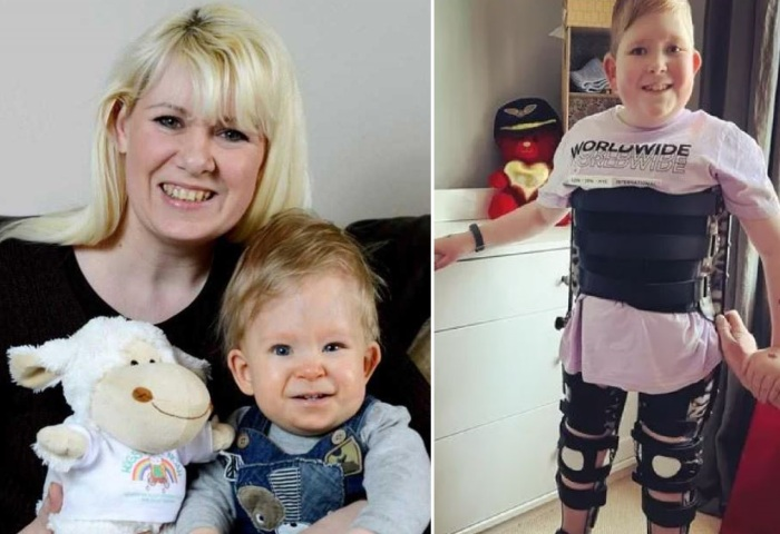 Как живёт родившийся без мозга 12-летний мальчик, которому родители заказали гробик ещё до появления на свет