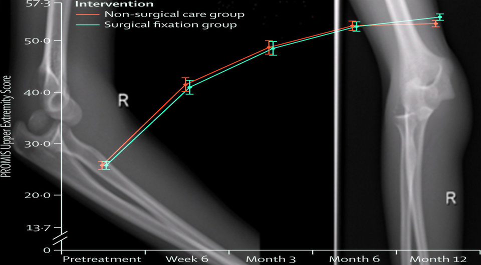   N + 1; M Subramaniam, P Hussin / The Internet Journal of Orthopedic Surgery, 2007; Daniel C Perry et al. / The Lancet, 2026