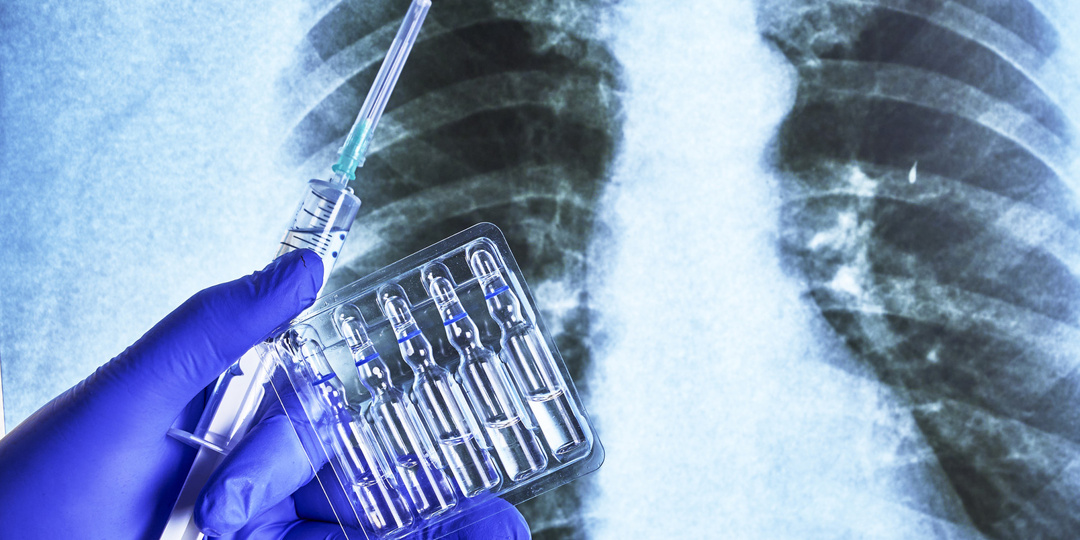 Обновлен стандарт помощи взрослым при туберкулезе: расширены диагностика и терапия