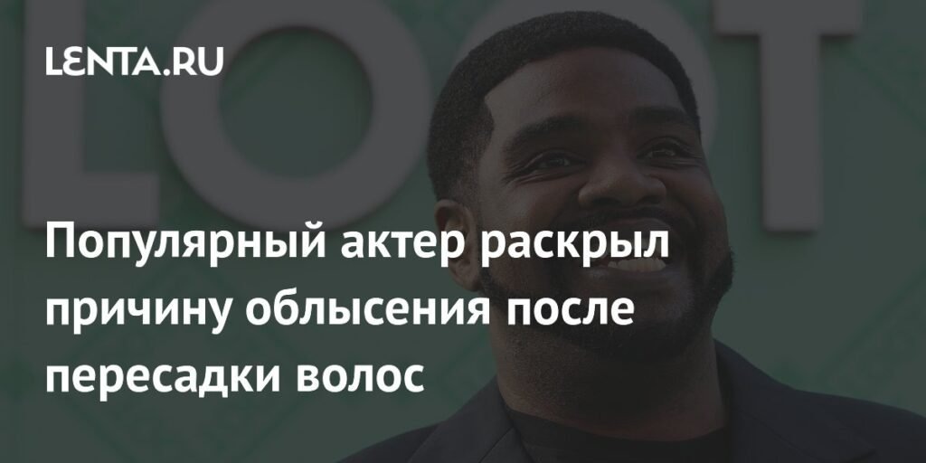    Рон Фанчес объяснил причину облысения после пересадки волос (источник изображения) News Express Team