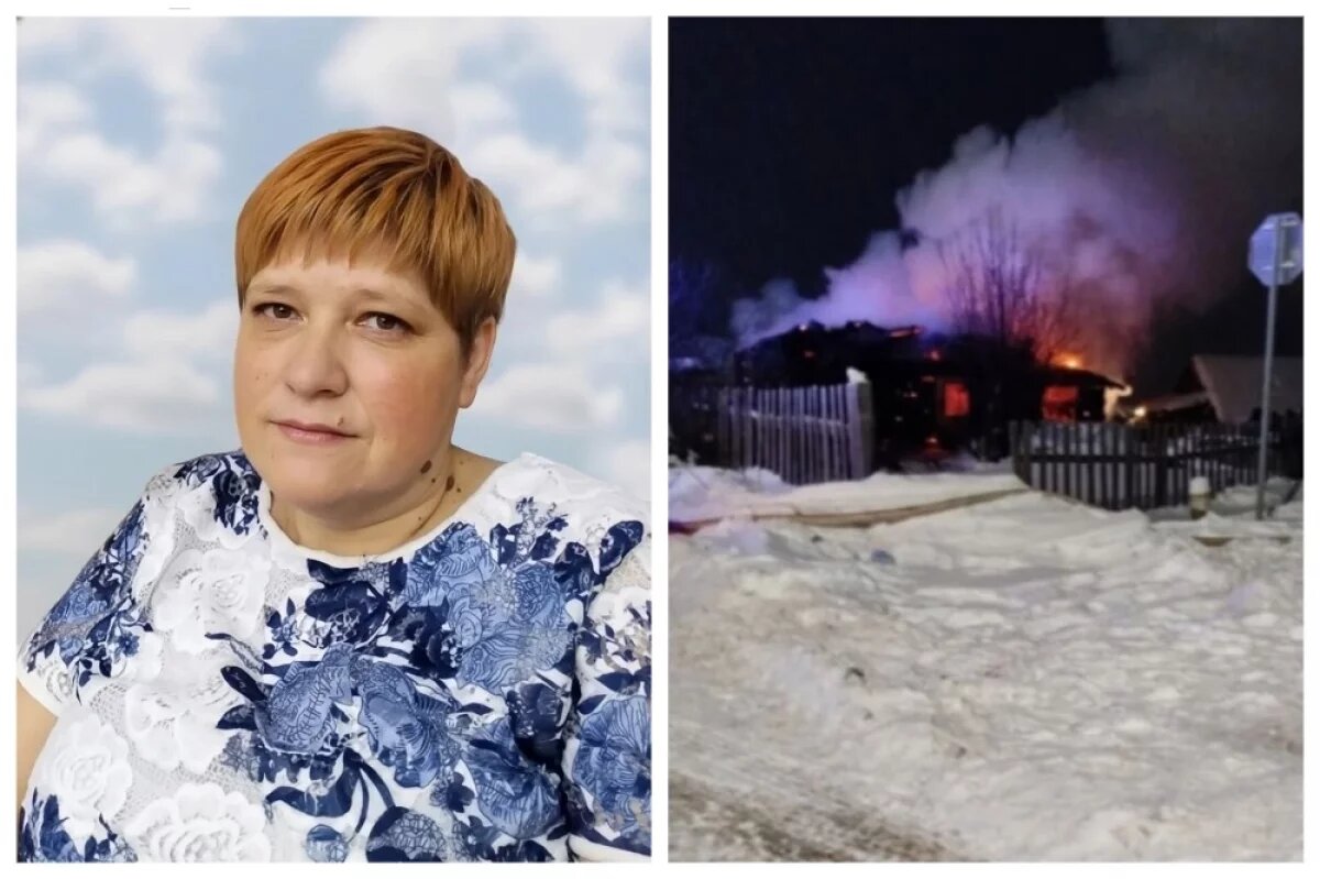    Анна Лоскутова получила страшные ожоги на пожаре, врачи не смогли ее спасти.