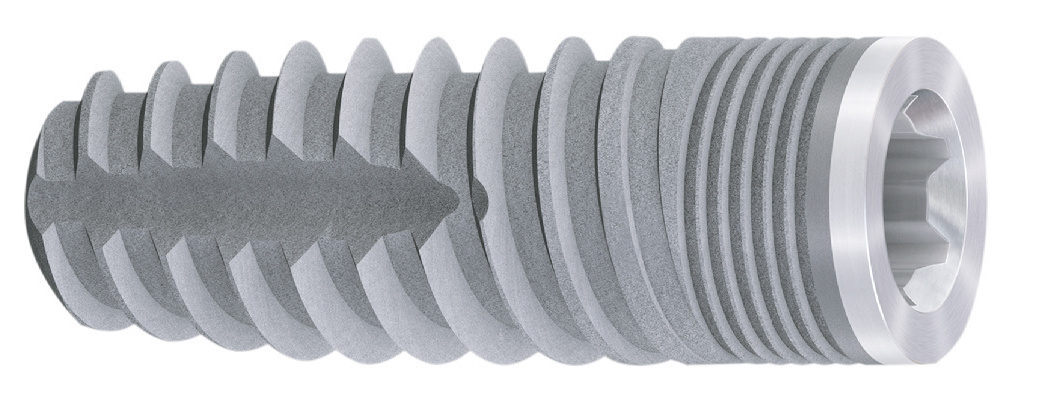 Рис. 1 Имплант BlueSky, используемый в клиническом исследовании.