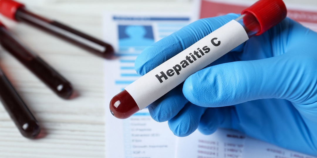 Обновлены клинические рекомендации по лечению гепатита С