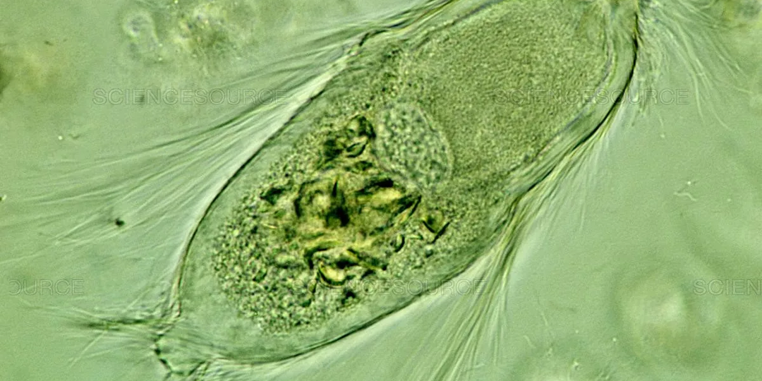 Тайны эукариот. Парабазалии