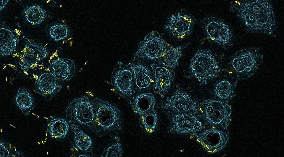   SNSF Scientific Image Competition / Flickr / CC BY-NC-ND 2.0