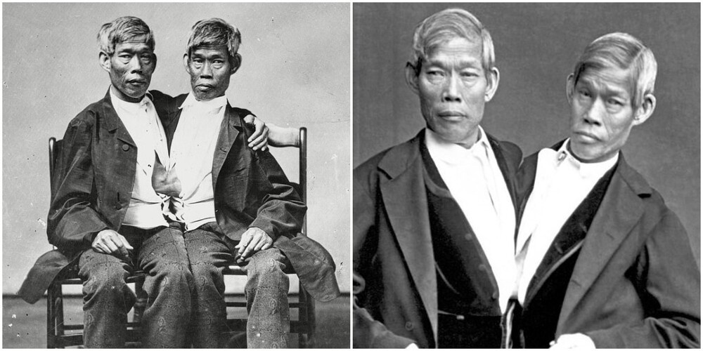 Чанг и Энг Банкеры (1811-1874).