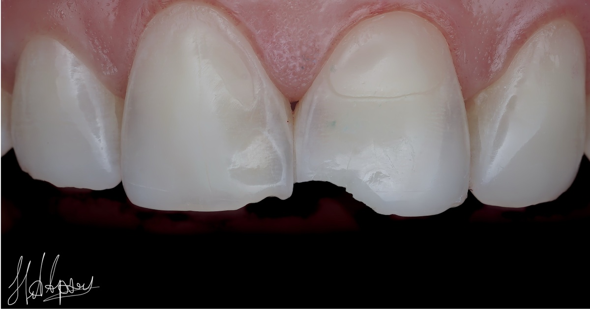 Исходная клиническая ситуация